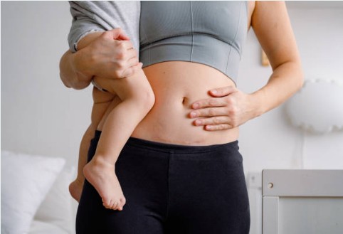 산모 붓기빼는 음식