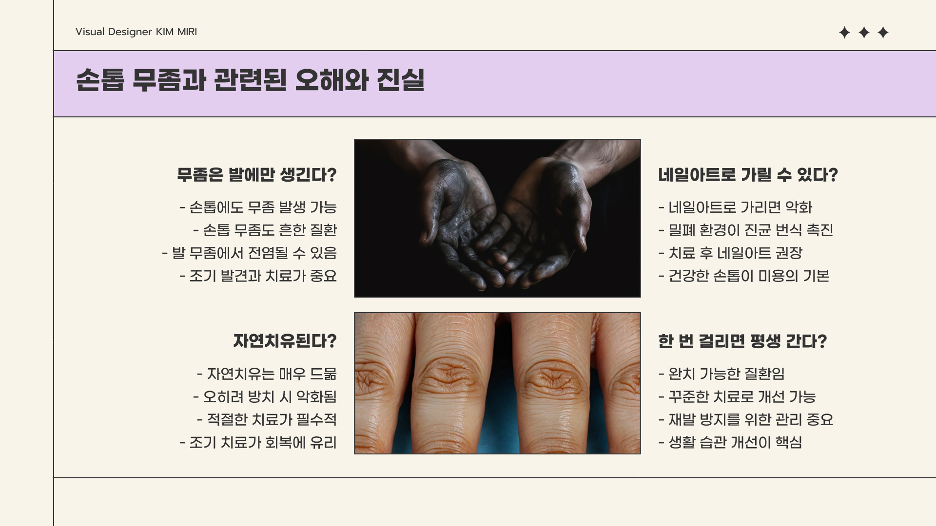 손톱 무좀