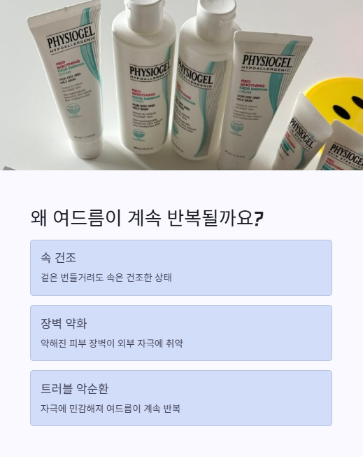 왜 여드름이 계속 반복될까요?
