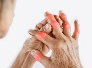 손가락 마디 통증