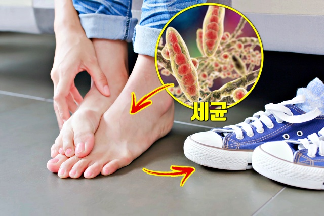 구두 발냄새 없애는법, 신발 냄새 없애는법, 샌들 냄재 제거, 무좀, 발냄새, 팁줌 매일꿀정보