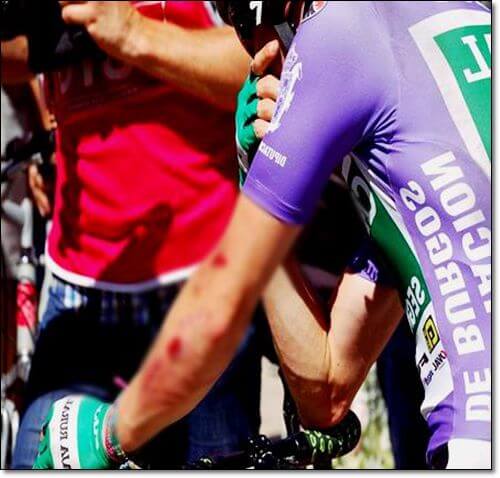 넘어져서 다친 사이클 선수