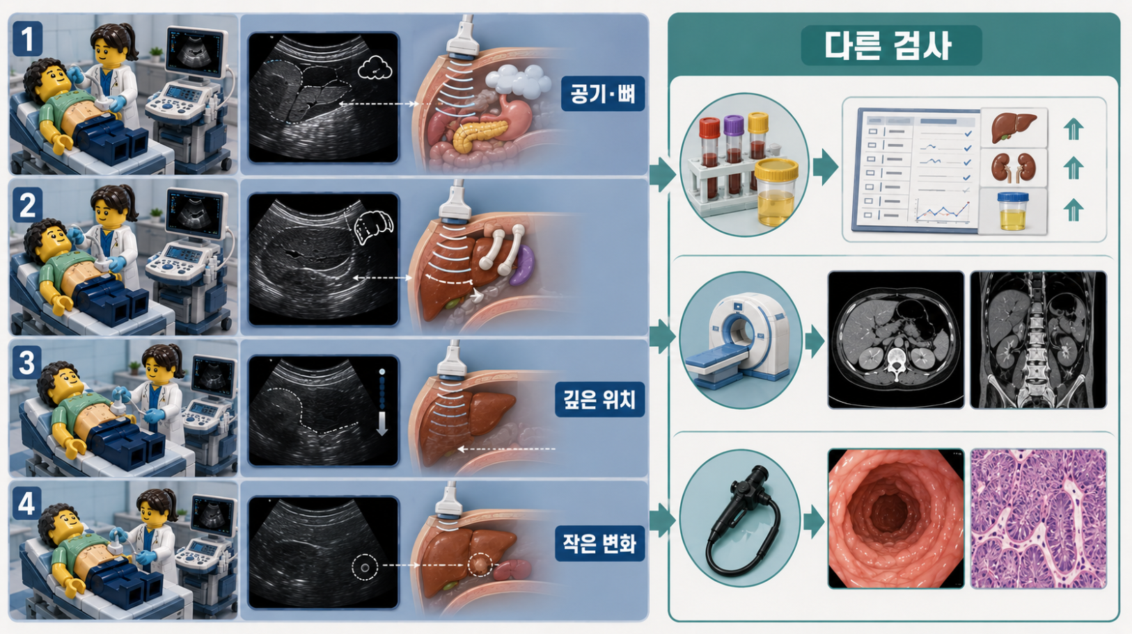 복부초음파 영상의 한계와 혈액검사&middot;CT&middot;MRI&middot;내시경으로 확인하는 정보 비교