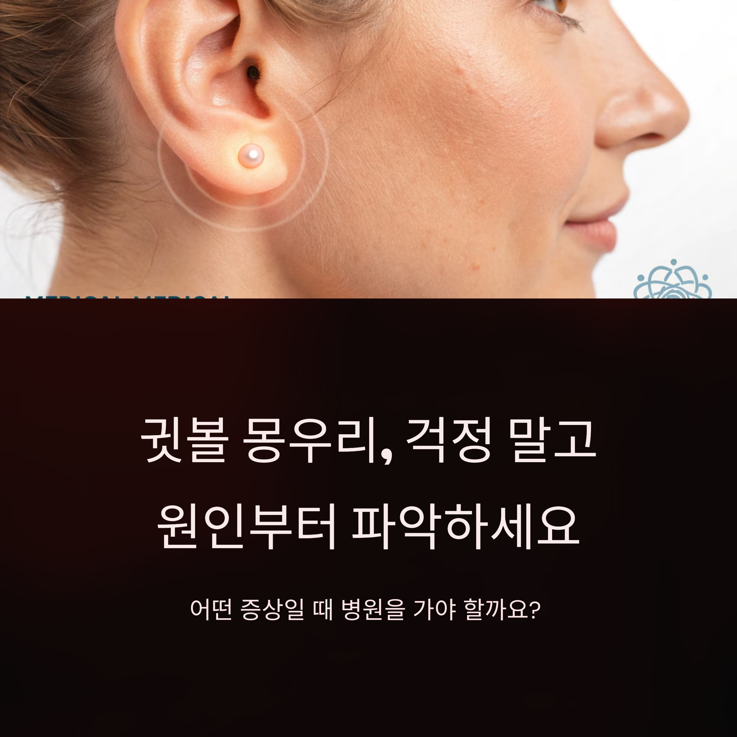 귓볼 몽우리