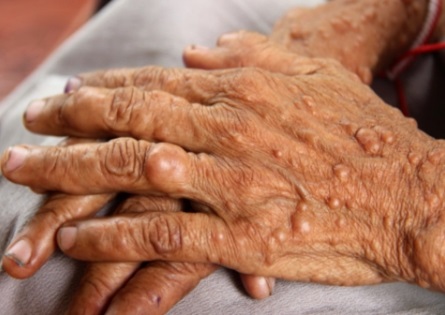 ์ ๊ฒฝ์ฌ์ ์ข