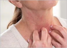 꽃가루와 알레르기 증상들 이미지