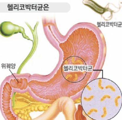 헬리코박터균 3