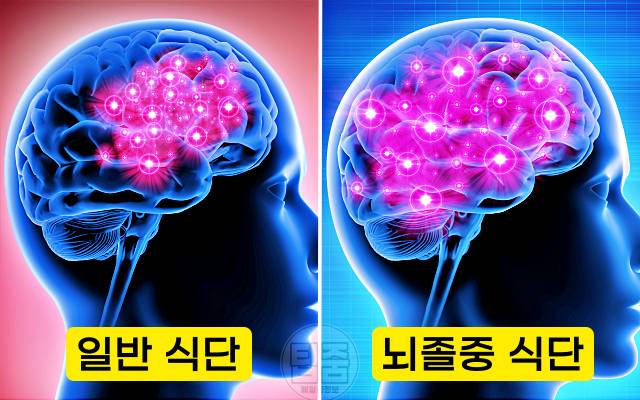 뇌졸중 회복 음식 뇌기능 회복 기간 단계 뇌졸중음식