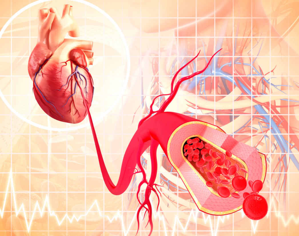 콜레스테롤 수치