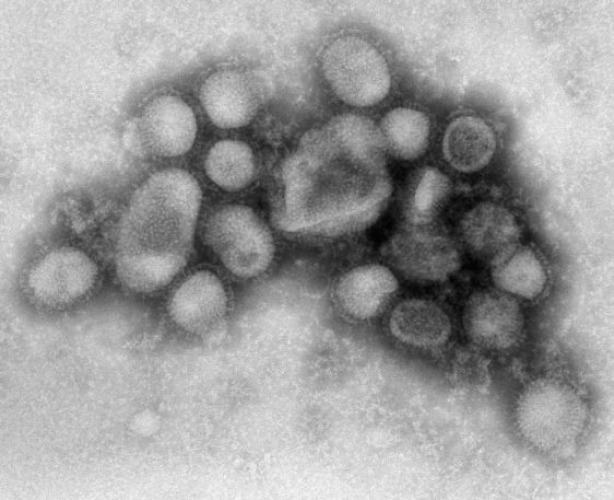 회색 둥근모양이 뭉쳐진 독감모양