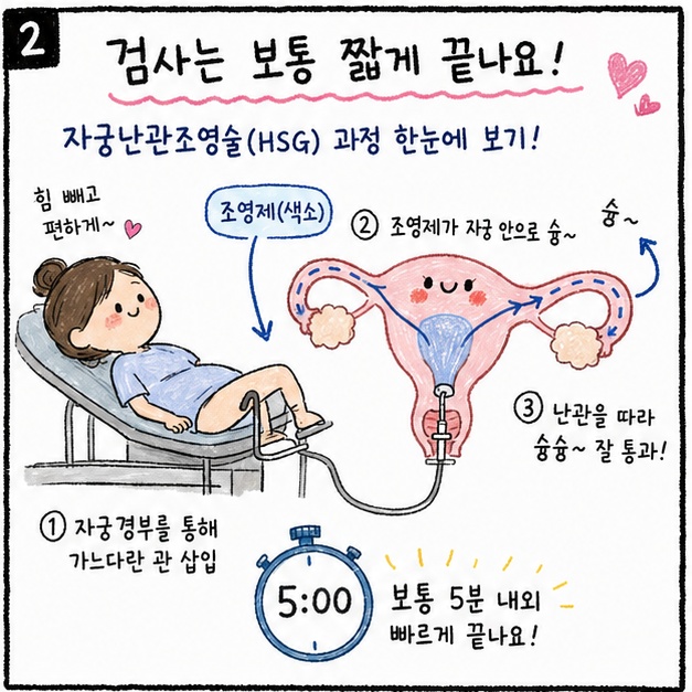 자궁난관조영술