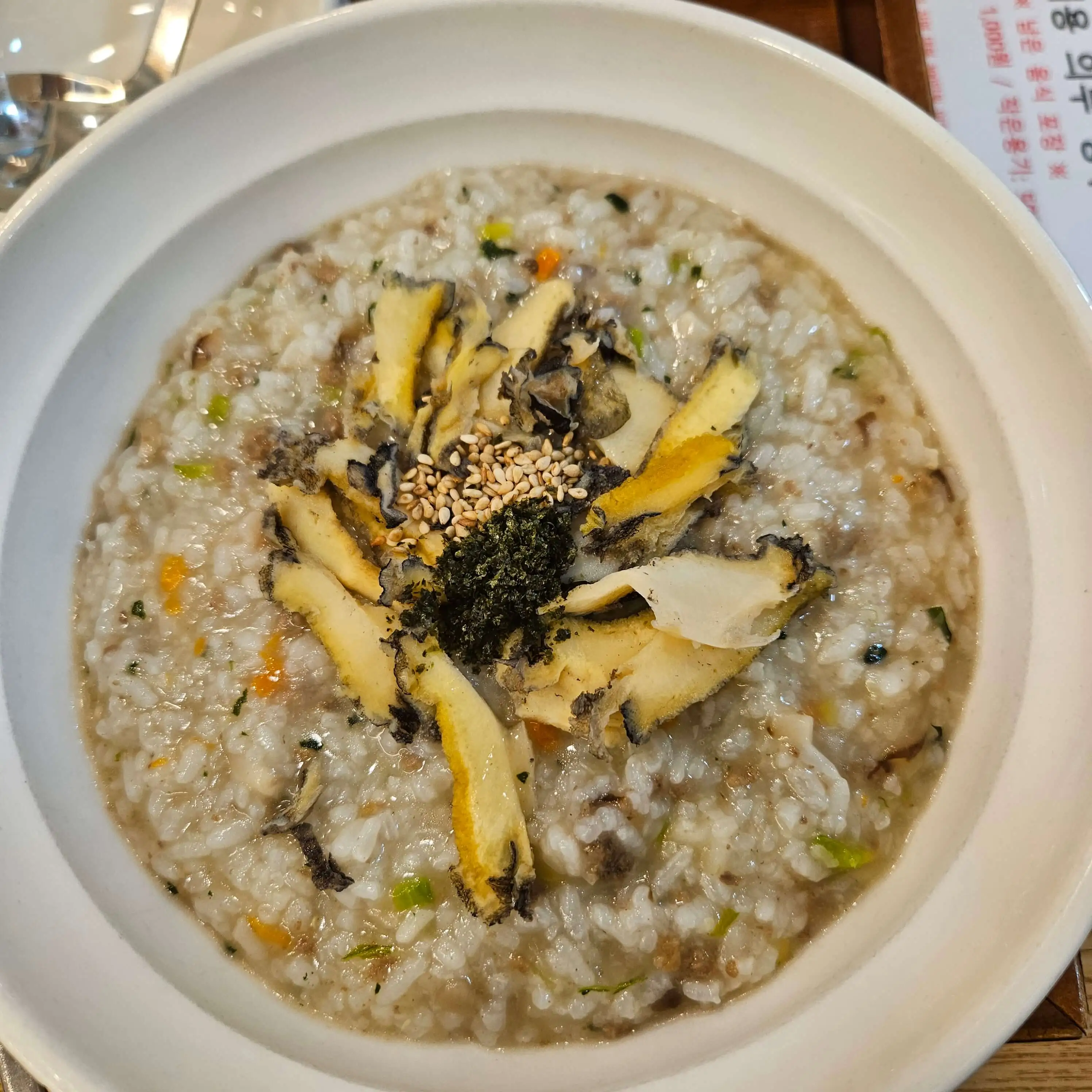 [성모병원 수술후기] 선천성 이루공 전신마취 수술&amp;#44; 의정부성모병원 입원 리얼경험