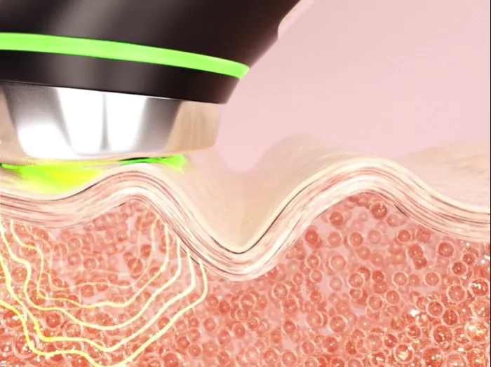 메디큐브 부스터프로 사용법 후기 효과 총정리