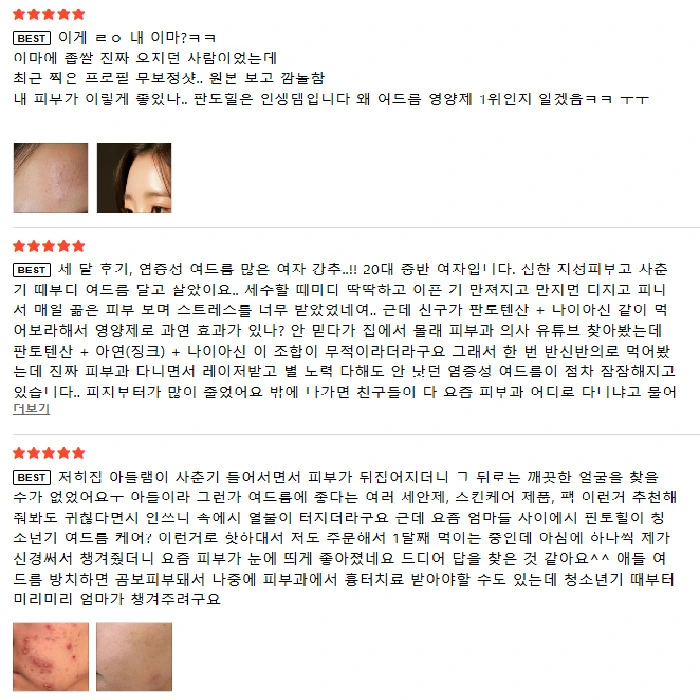 에보덤 판토힐 내돈내산 후기 부작용 효능 복용법 가격
