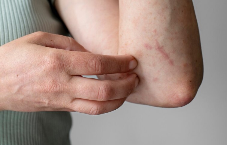 토마토 효능 부작용