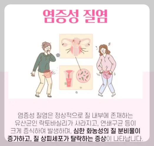 질염