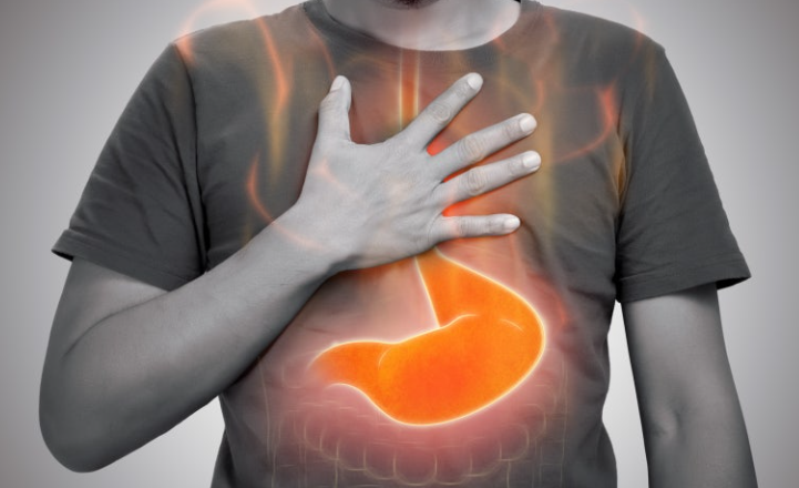 위산 역류: 단순한 속 쓰림을 넘어선 복합적인 건강 문제