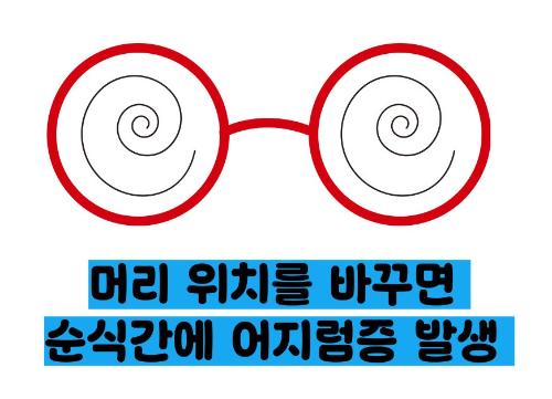 이석증 증상