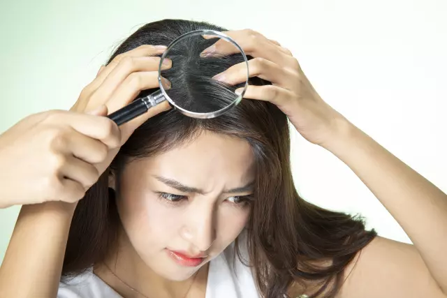 탈모(Hair loss)