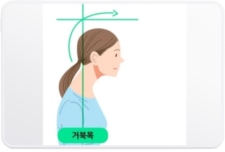 거북목