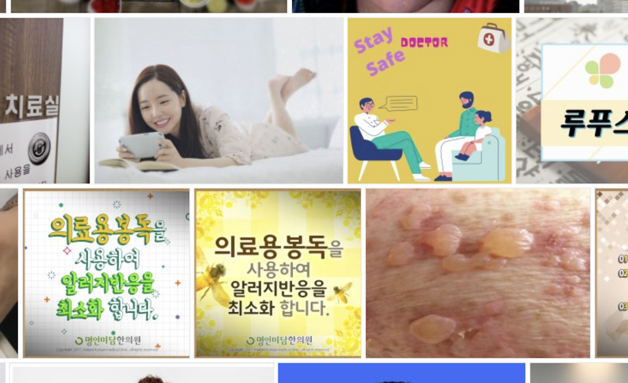 루푸스증상과원인치료법