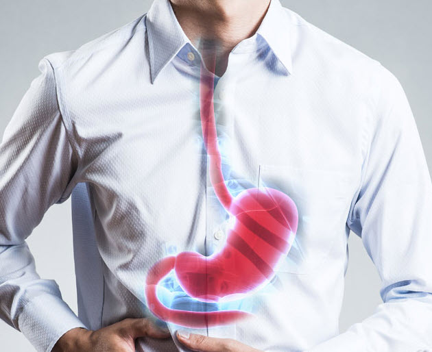 남성 역류성식도염 