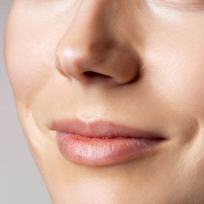 2. 색소침착 제거 연고와 크림의 사용