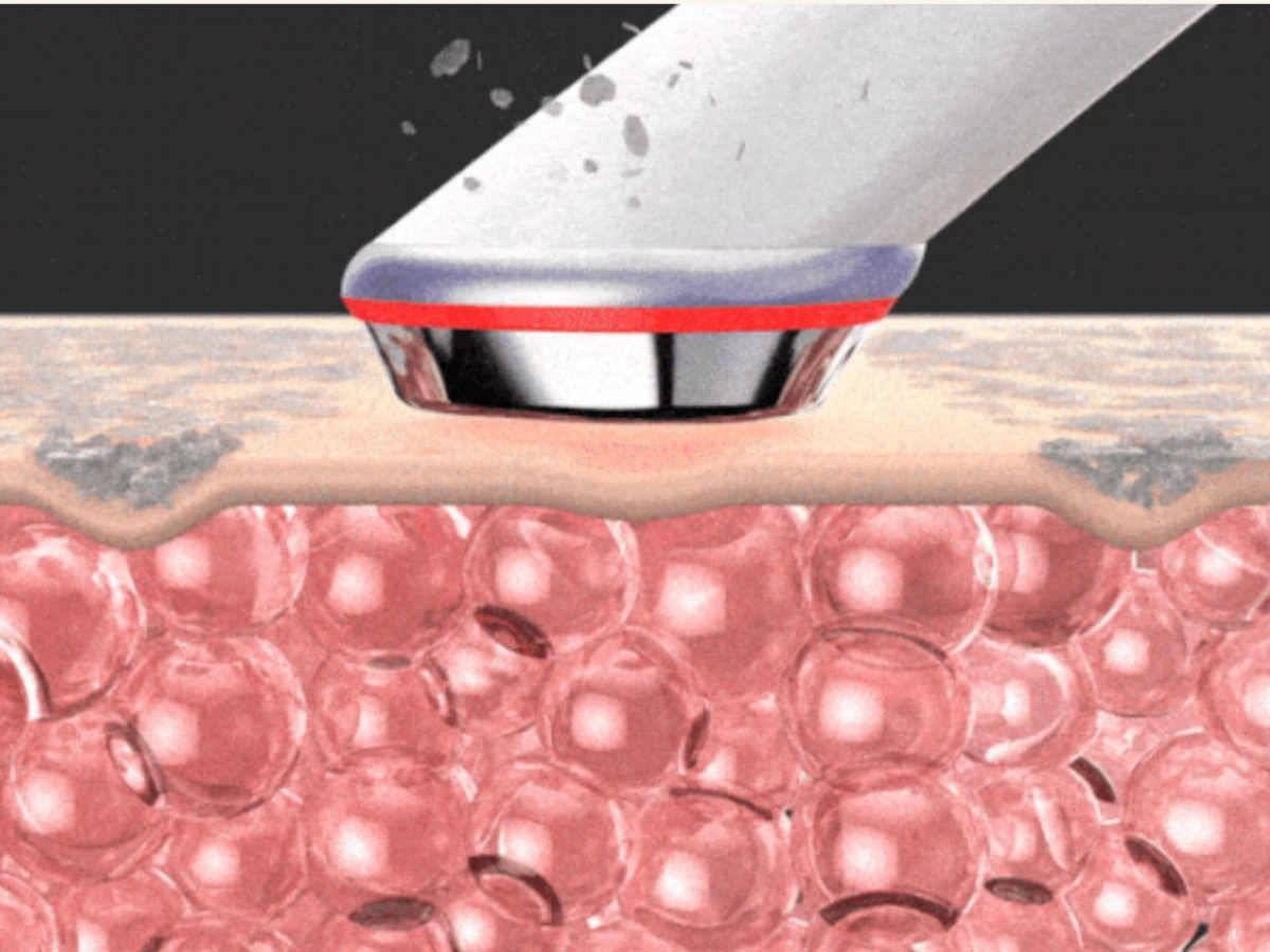 브라이트닝 모드