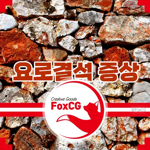 요로결석 증상&#44; 원인과 치료&#44; 좋은 음식은?