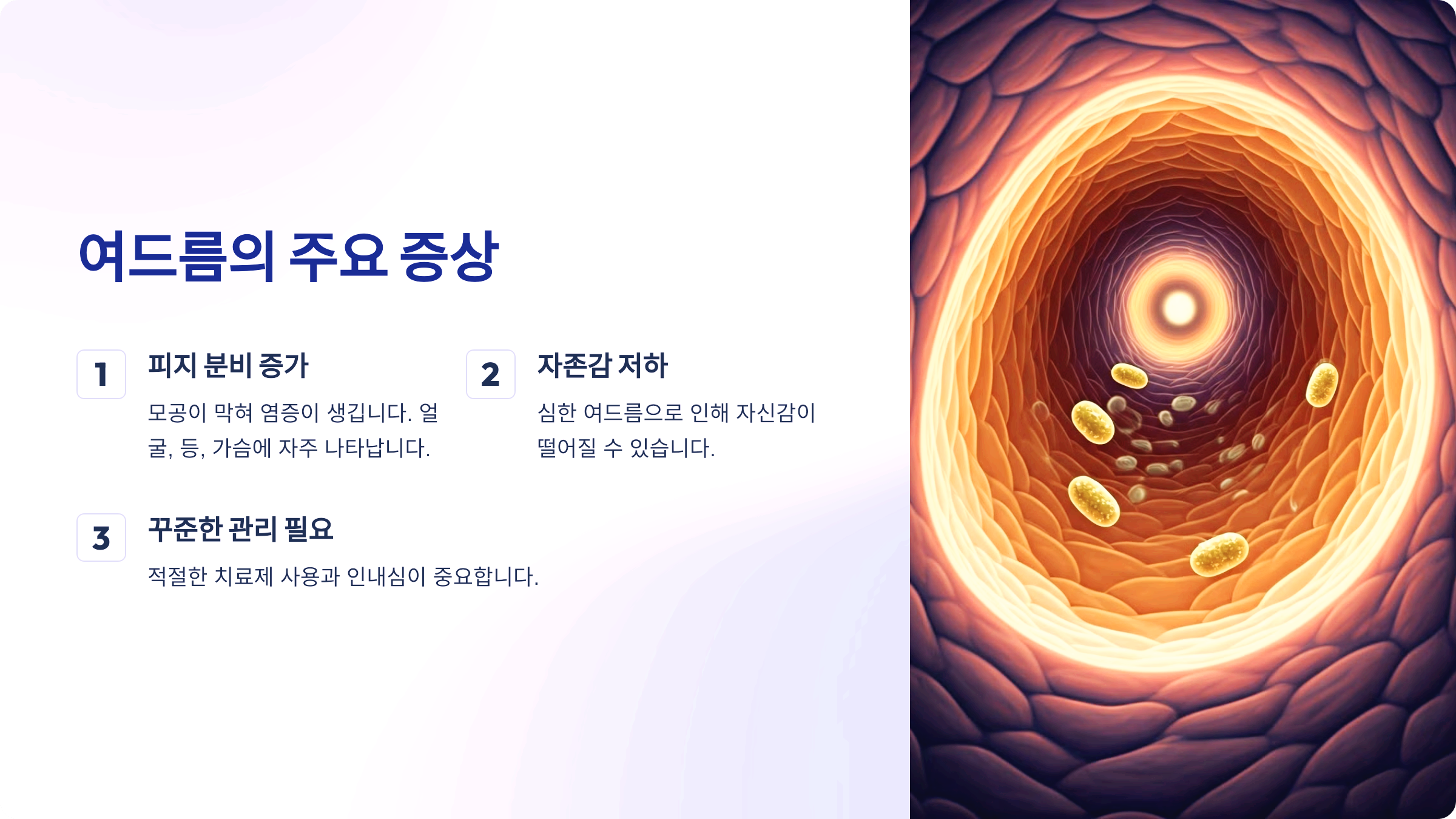 여드름의 주요 증상