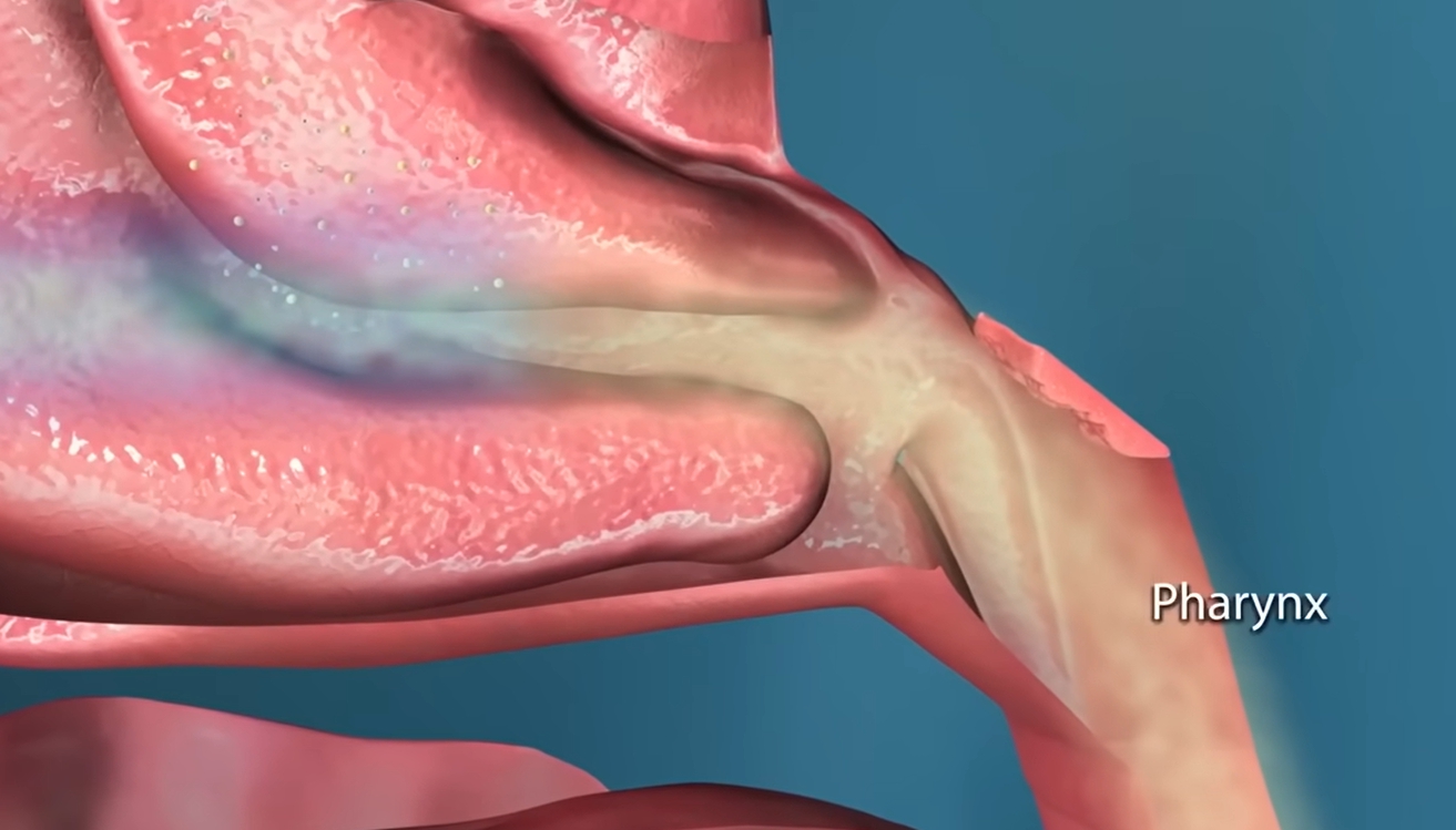 콧물이 계속 나는 이유