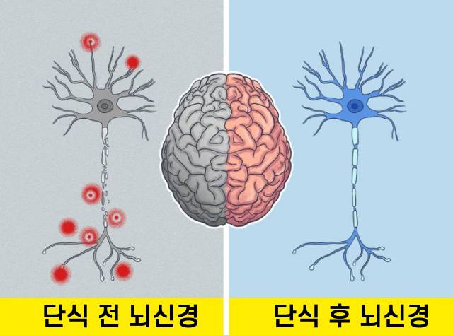간헐적단식 한달 효과, 뇌졸중 재활