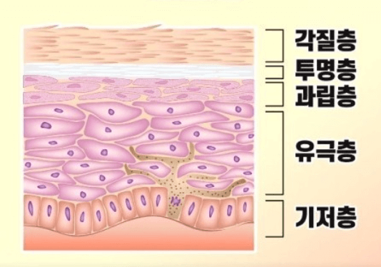 민감성 피부 체크 방법