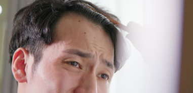 남성 탈모