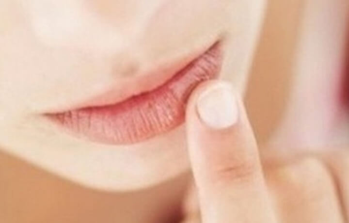 입술-각질-제거