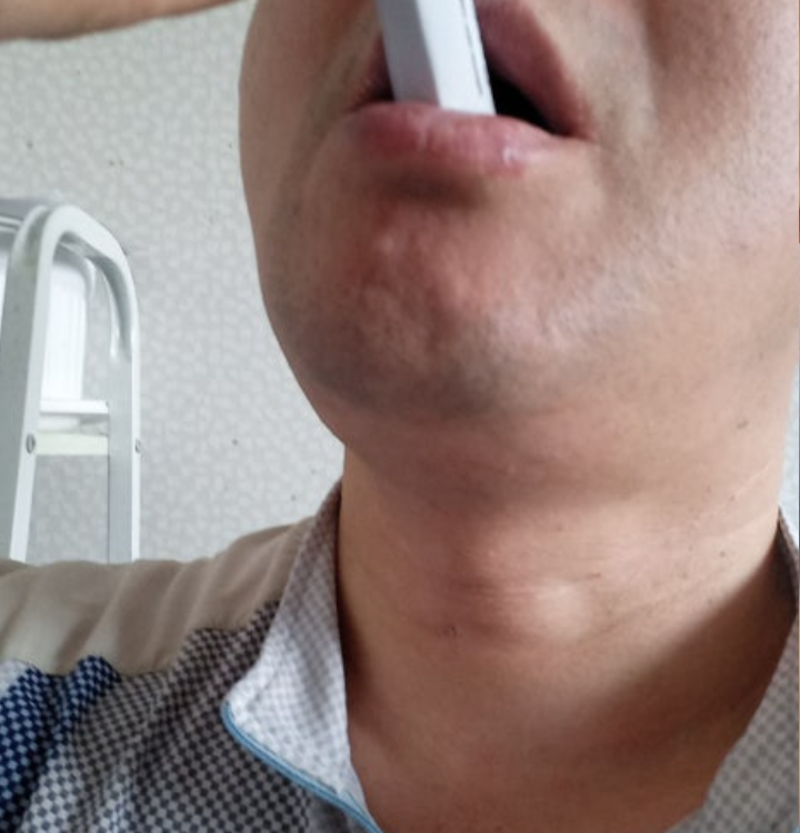덴티오클린 내돈내산 구강유산균
