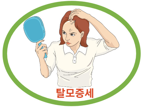 탈모증세