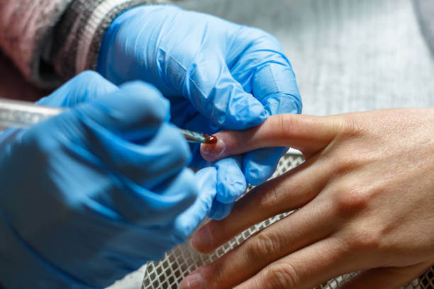 조갑주위염&amp;#44; 손톱염증을 일으키는 거스러미를 아시나요? 나도 모르게 항상 입으로 손을 뜯고 있는 나를 발견하는데요. 절대로 하지 말아야 할 행동입니다. 아무 생각없이 뜯고 있으면 피까지 나올 때가 있습니다. 왜 생기고 어떻게 예방을 해야 하는 걸까요? 