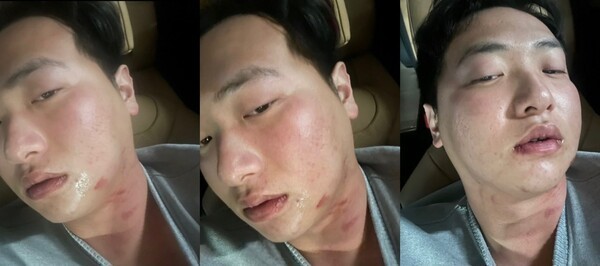 김하성 선수 폭행사건