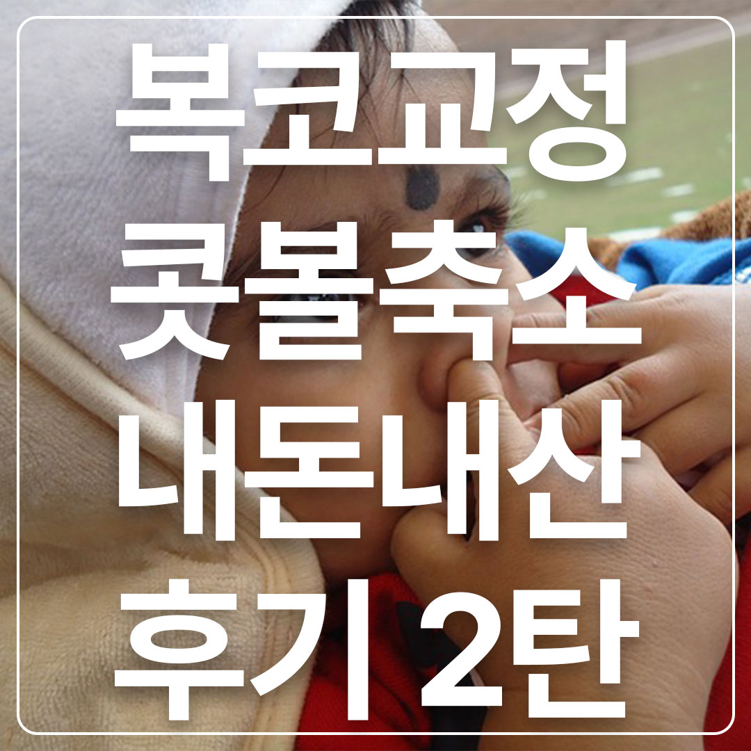콧볼축소수술후기
