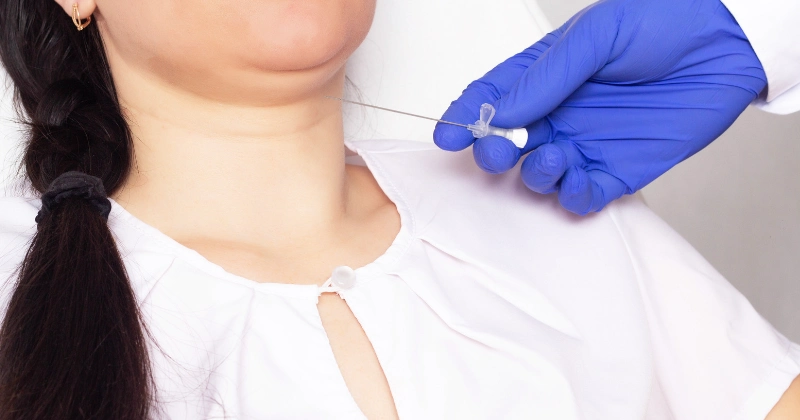 목에 실리프팅 시술 진행