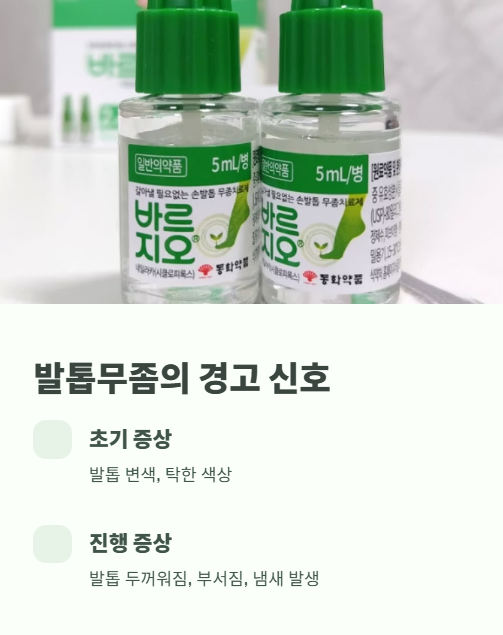 발톱무좀의 경고 신호