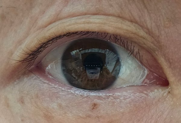 정면을 바라고있는 눈