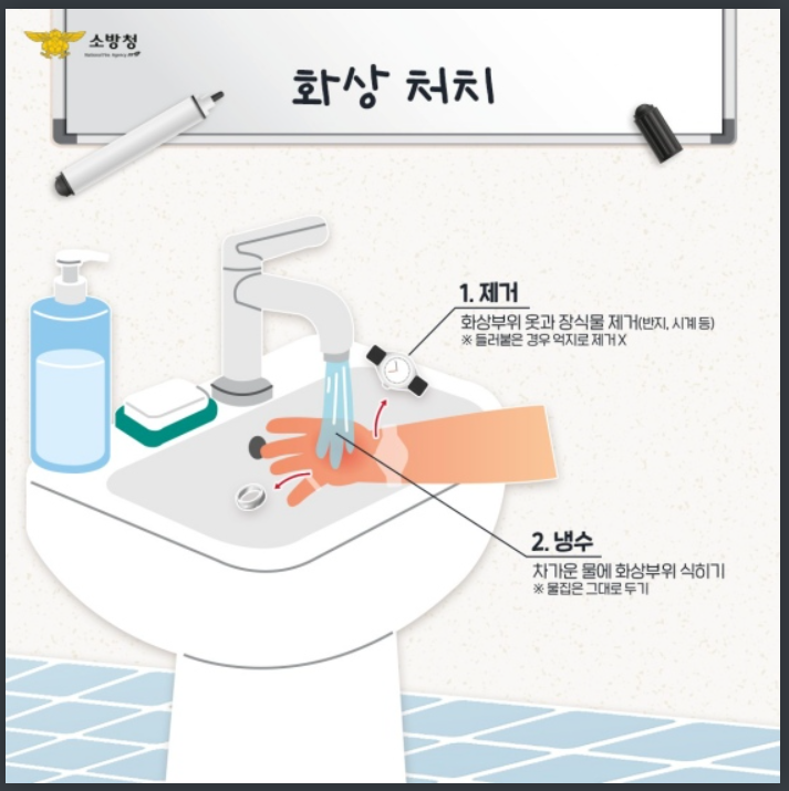 화상 응급처치
