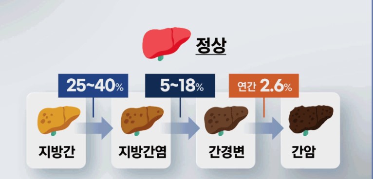 지방간
