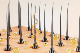 지루성 두피염 증상6