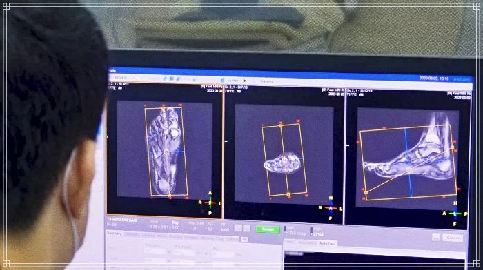 생로병사의 비밀 873회 맨발로 걸으면 생기는 일, 효능, 방법, 운동 효과, 시간, 장소 정보 방법