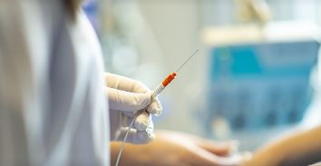 원형탈모 치료약