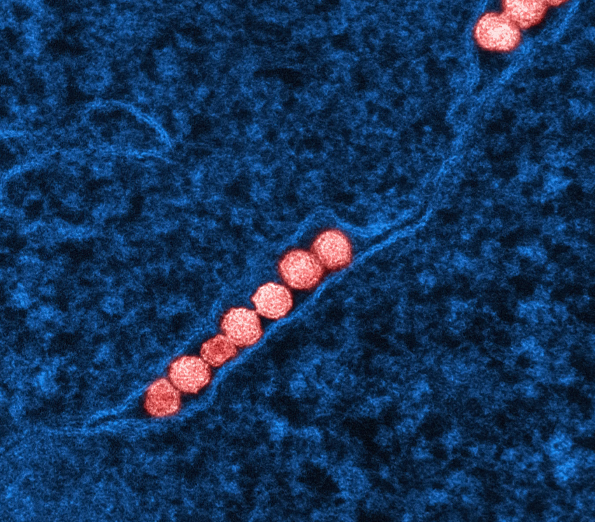 헬리코박터균 전염