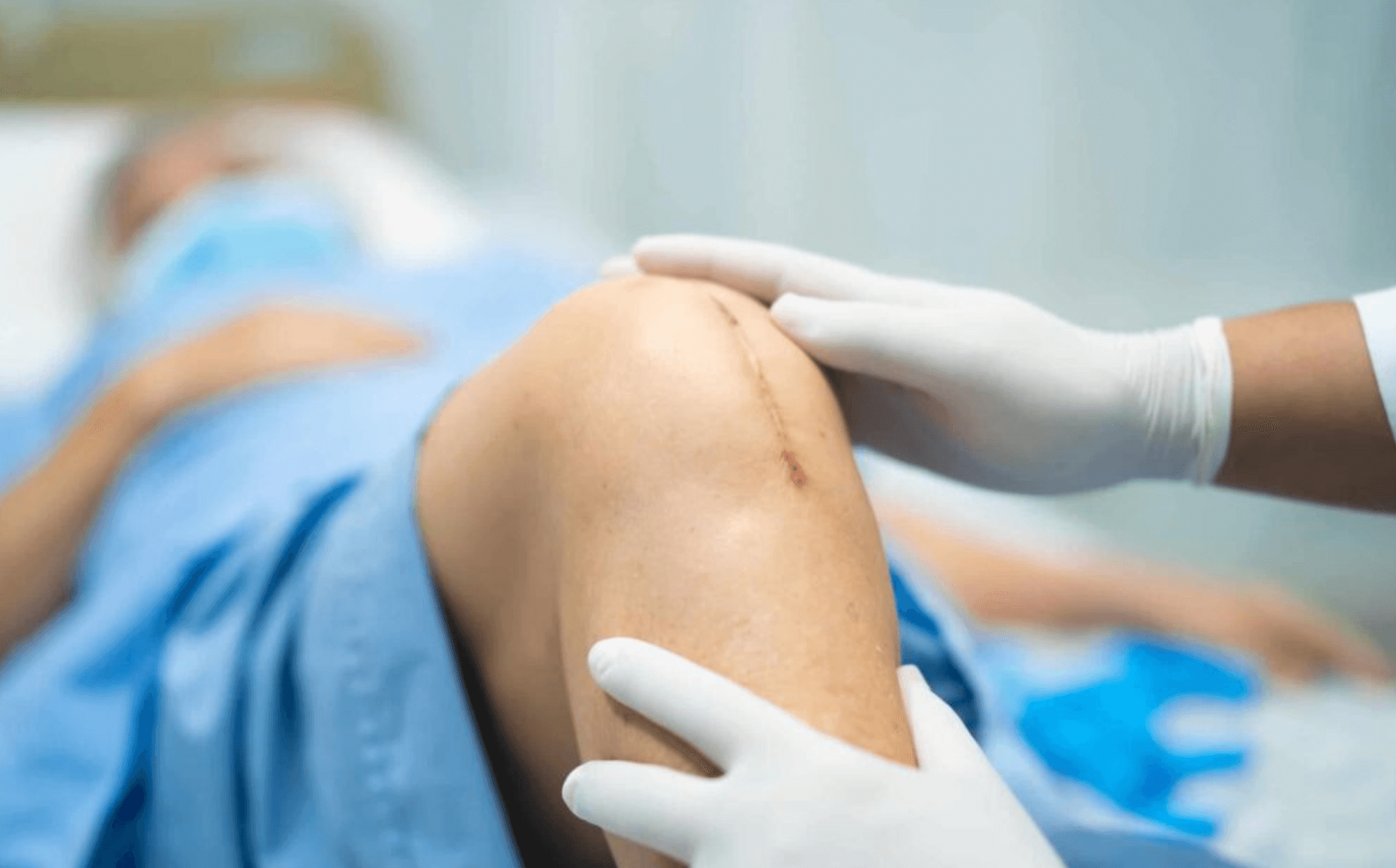 무릎 인공관절 수술 회복기간